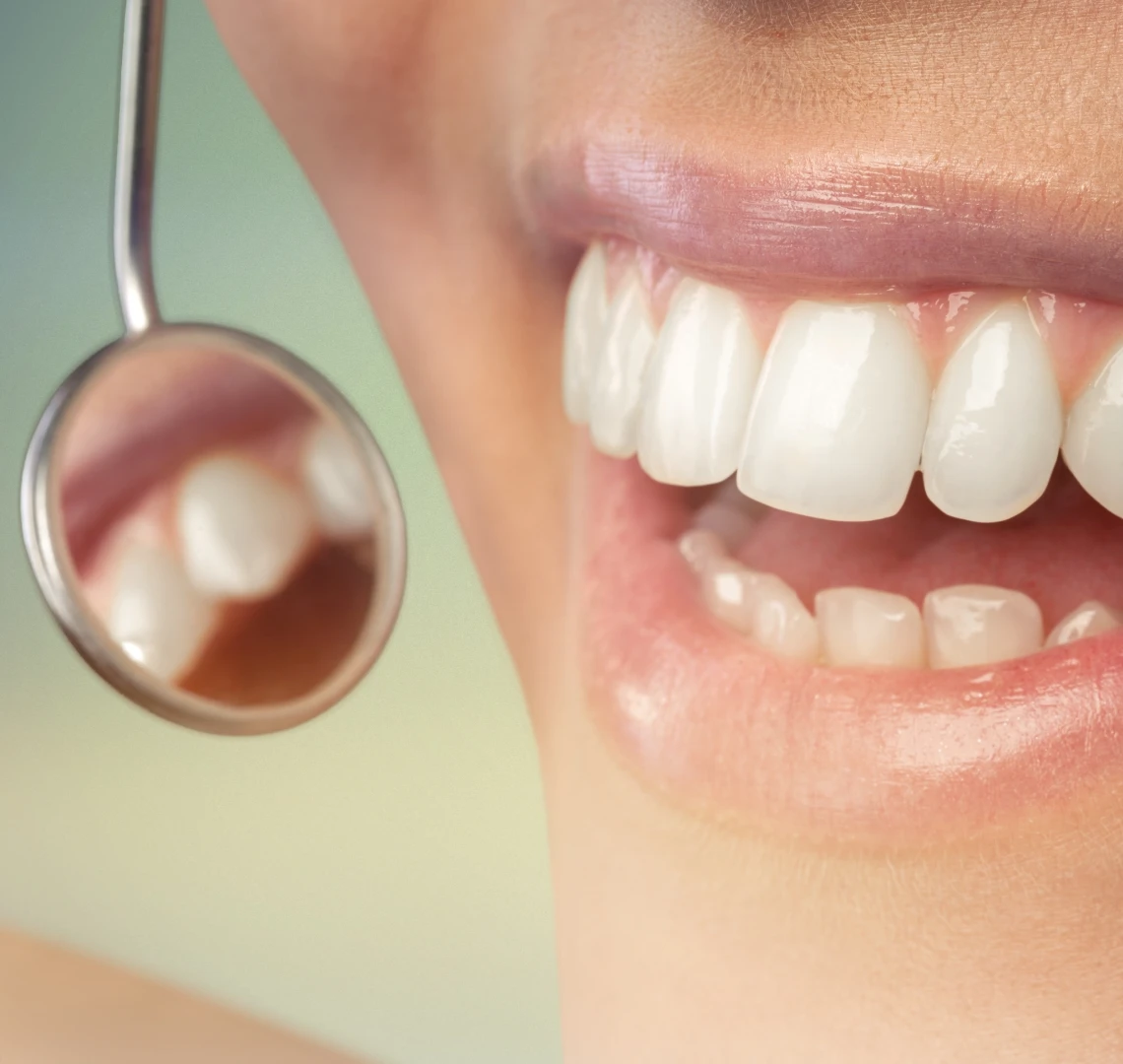 Bilan parodontal au cabinet du Dr Bennani Ribet à Menton