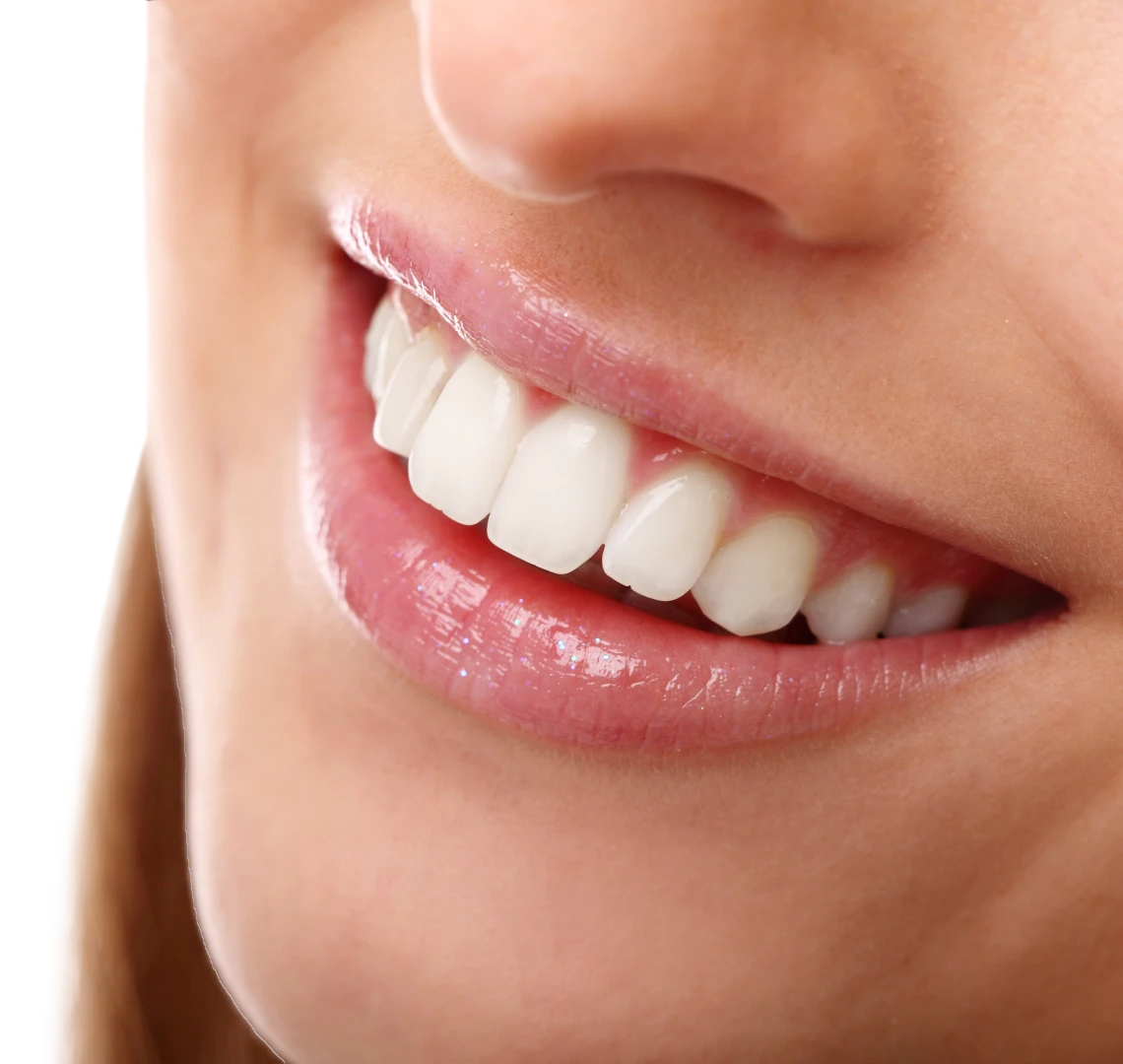 Réhabilitation esthétique au cabinet du Dr Maha BENNANI RIBET à Menton