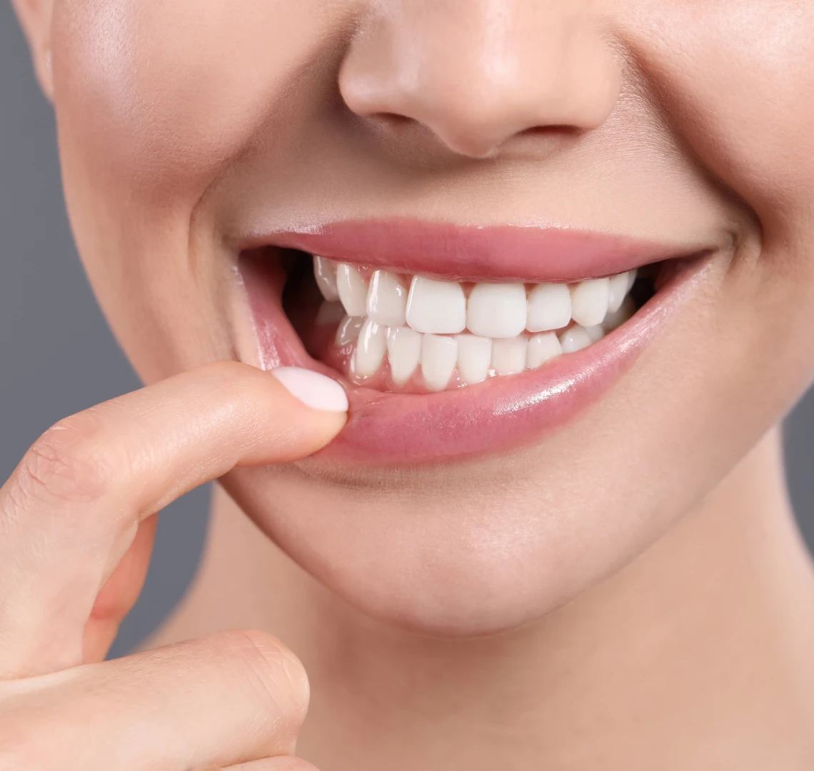 Régénération parodontale au cabinet du Dr Bennani Ribet à Menton proche Monaco