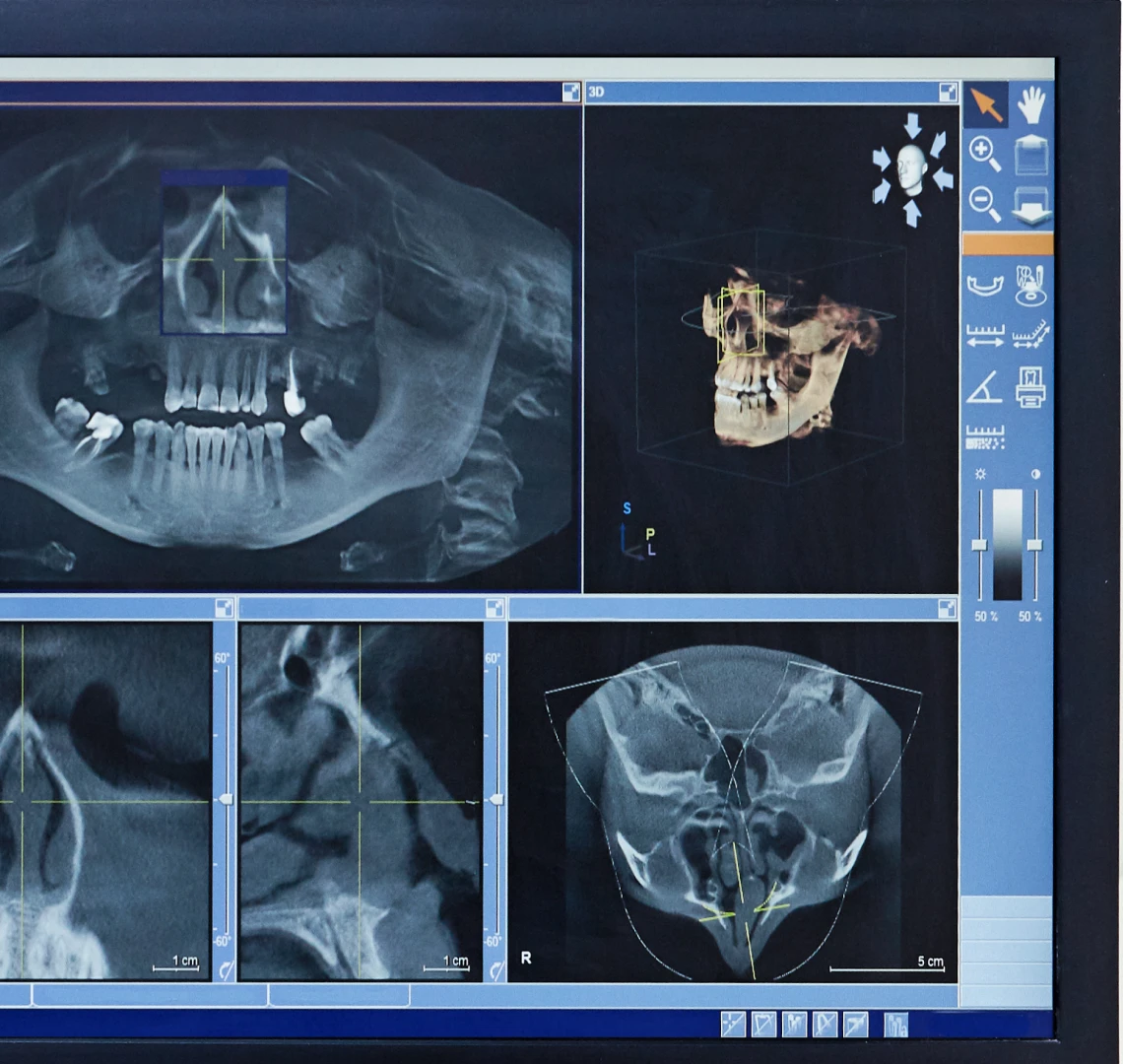 Flux numérique en implantologie au cabinet de parodontologie et d'implantologie du Dr Bennani Ribet à Menton, proche de Monaco